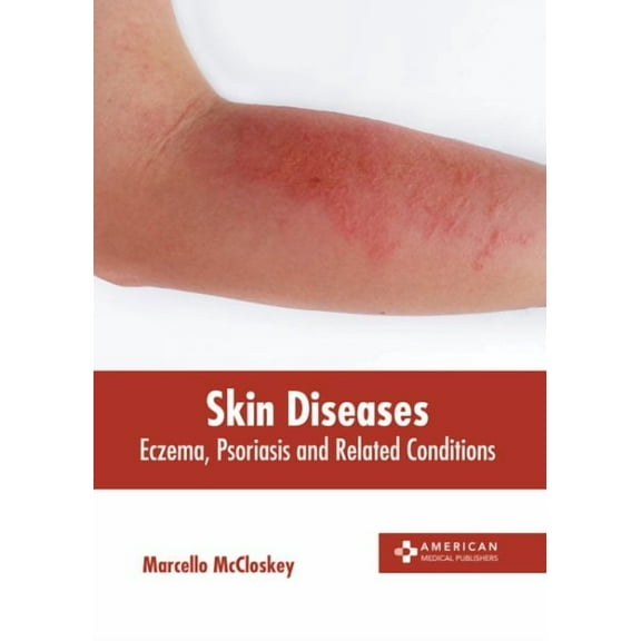 Skin Diseases: Eczema, Psoriasis and Related Conditions (Hardcover)