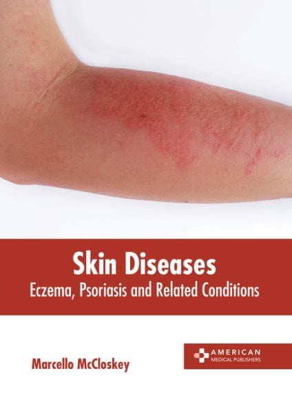 Book On Skin Rashes Skin Diseases: Eczema, Psoriasis and Related Conditions (Hardcover ...