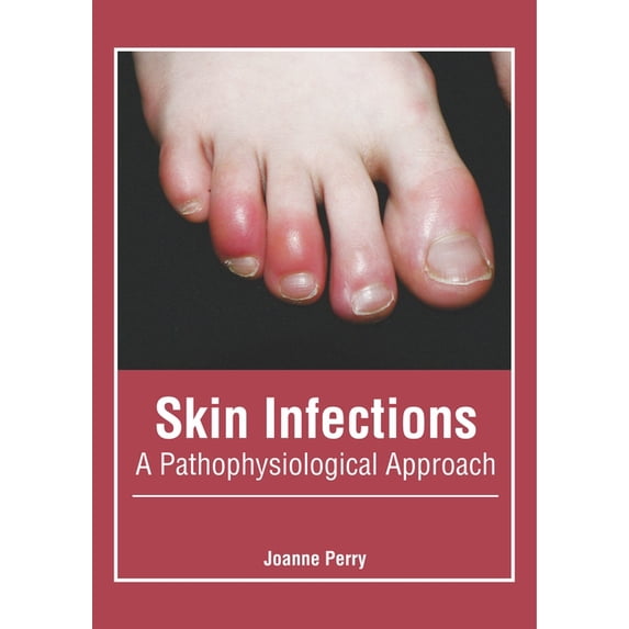 Skin Infections Journal Skin Infections: A Pathophysiological Approach, (Hardcover) - Walmart.com