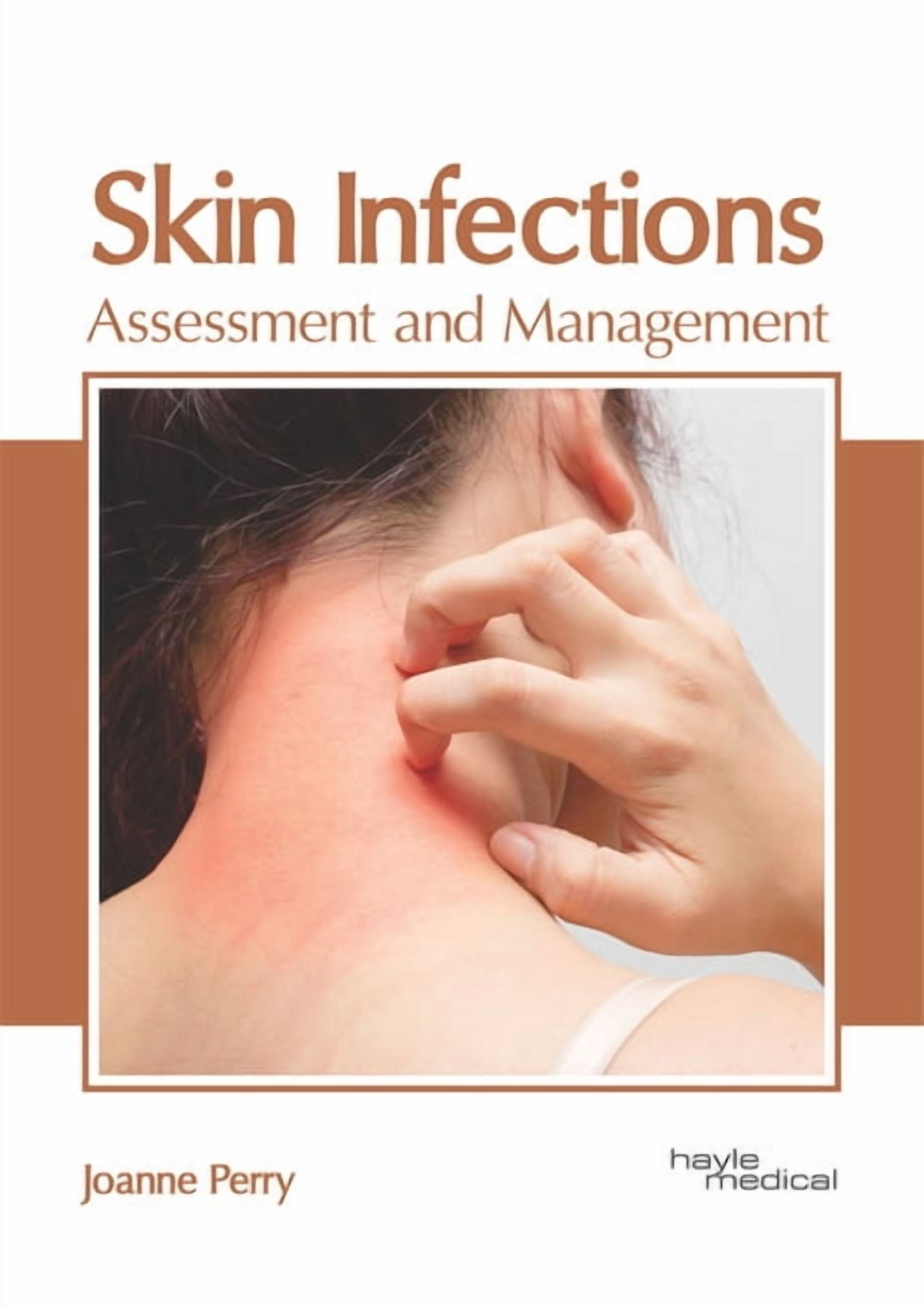 Skin Infections Journal Skin Infections: Assessment and Management, (Hardcover) - Walmart.com