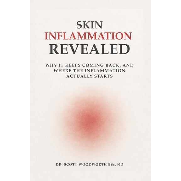 Chronic Inflammation and Your Diet Skin Inflammation Revealed: Why It Keeps Coming Back, And Where The Inflammation Actually Starts, Book 10, (Paperback)