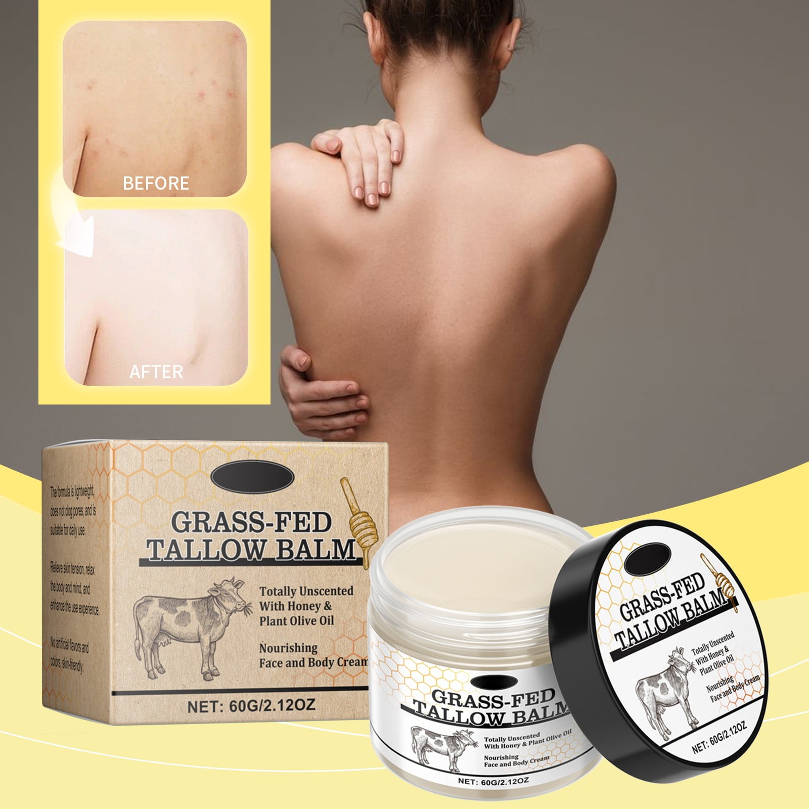 Skin Moisturizing Tallow Dry Skin Nourishes The Pro Cellulite Remover