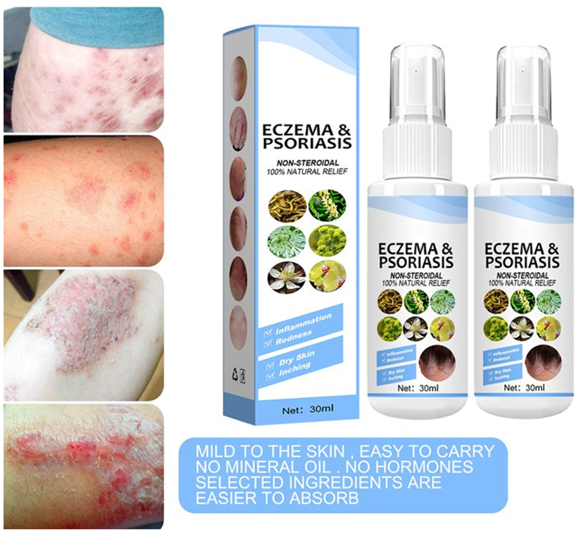 Skin Repair Spray Psoriasis Dermatitis Spray Eczema Spray For Smelly Feet and Eczema