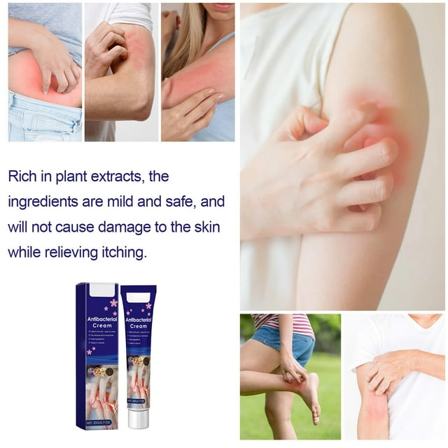 Skincare For Sensitive Skin Viola Vulgaris Ointment Skin Skin Itchy