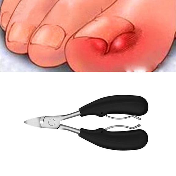 SkyAuks Nail Clippers, Pedicure Tools for Feet, Treatment Thick or Ingrown Toe Nails, Heavy Duty Soft Grip Tool Use for Family Double Spring Nail Cuticle Scissors, Black