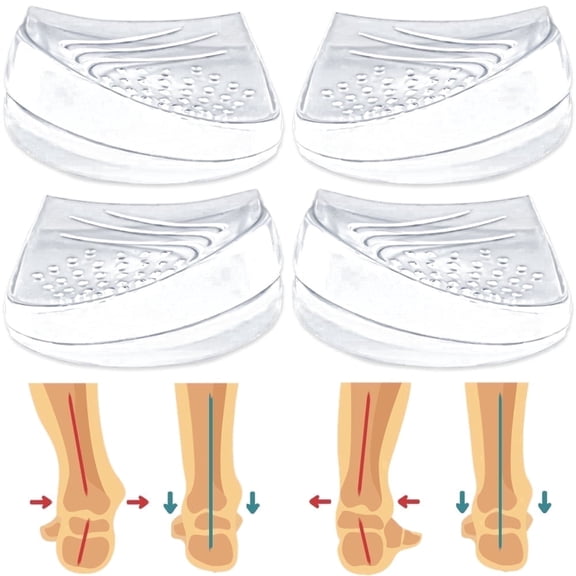 Skyfoot 2 Pairs 2 Layers Adjustable Heel Wedge Inserts for Supination & Pronation Correction, Adhesive Medial & Lateral Heel Insoles for Bow Legs, Knee Pain, Foot Alignment