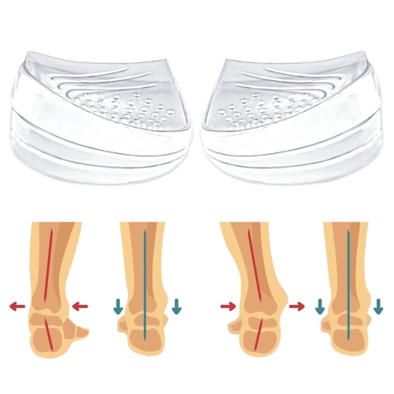 Skyfoot 3 Layers Adjustable Heel Wedge Inserts for Supination & Pronation Correction, Adhesive Medial & Lateral Heel Insoles for Bow Legs, Knee Pain, Foot Alignment