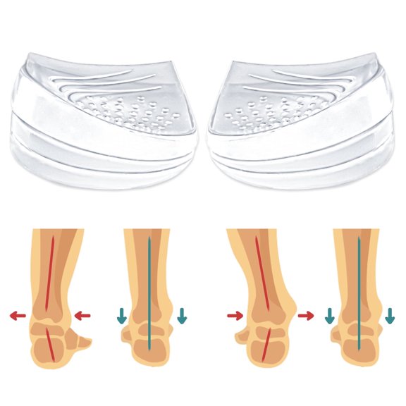 Skyfoot 3 Layers Adjustable Heel Wedge Inserts for Supination & Pronation Correction, Adhesive Medial & Lateral Heel Insoles for Bow Legs, Knee Pain, Foot Alignment