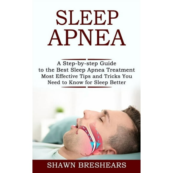 Sleep Apnea: A Step-by-step Guide to the Best Sleep Apnea Treatment (Most Effective Tips and Tricks You Need to Know for, (Paperback)