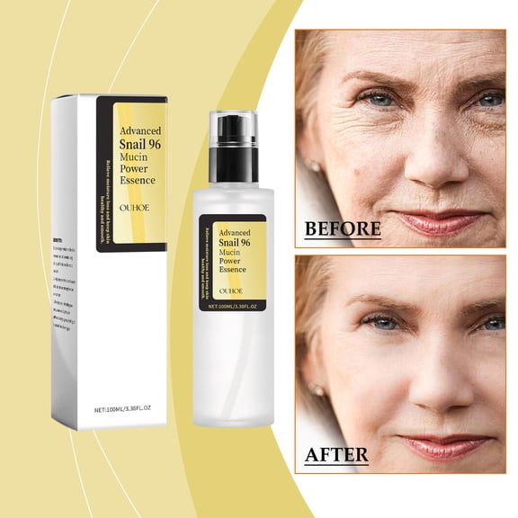 Snail Moisturizing Essence Water Hydrates, Moisturizes, Improves Skin Dryness, and Nourishes Facial Care Essence