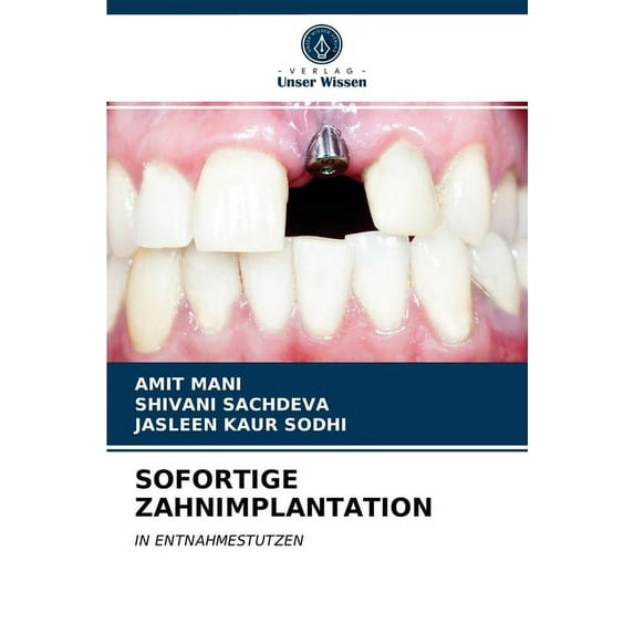 Sofortige Zahnimplantation (Paperback)