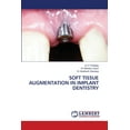 thumbnail image 1 of Soft Tissue Augmentation in Implant Dentistry, (Paperback), 1 of 1