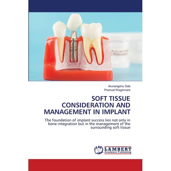 Soft Tissue Consideration and Management in Implant, (Paperback)