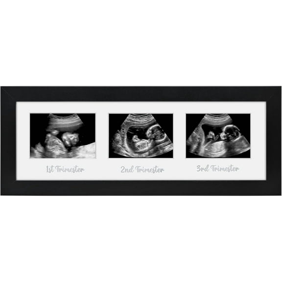 Sonogram Picture Frame with Shatter-Resistant Glass - 15x5 Frame Fits Three 3x4 Sonograms with Interchangeable Mats - Signature Collection - Photo Frames for Tabletop and Wall - Black