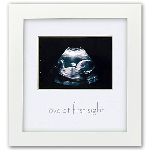 Ultrasound Picture Frames – MAMA loves MINI