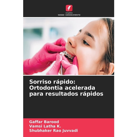 Sorriso rpido: Ortodontia acelerada para resultados rpidos, (Paperback)