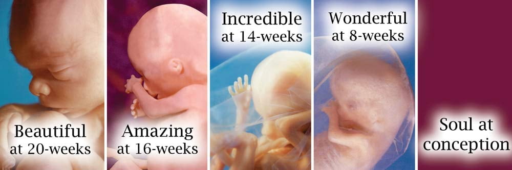 Soul at Conception Pro-Life Bookmark (Pack of 100)