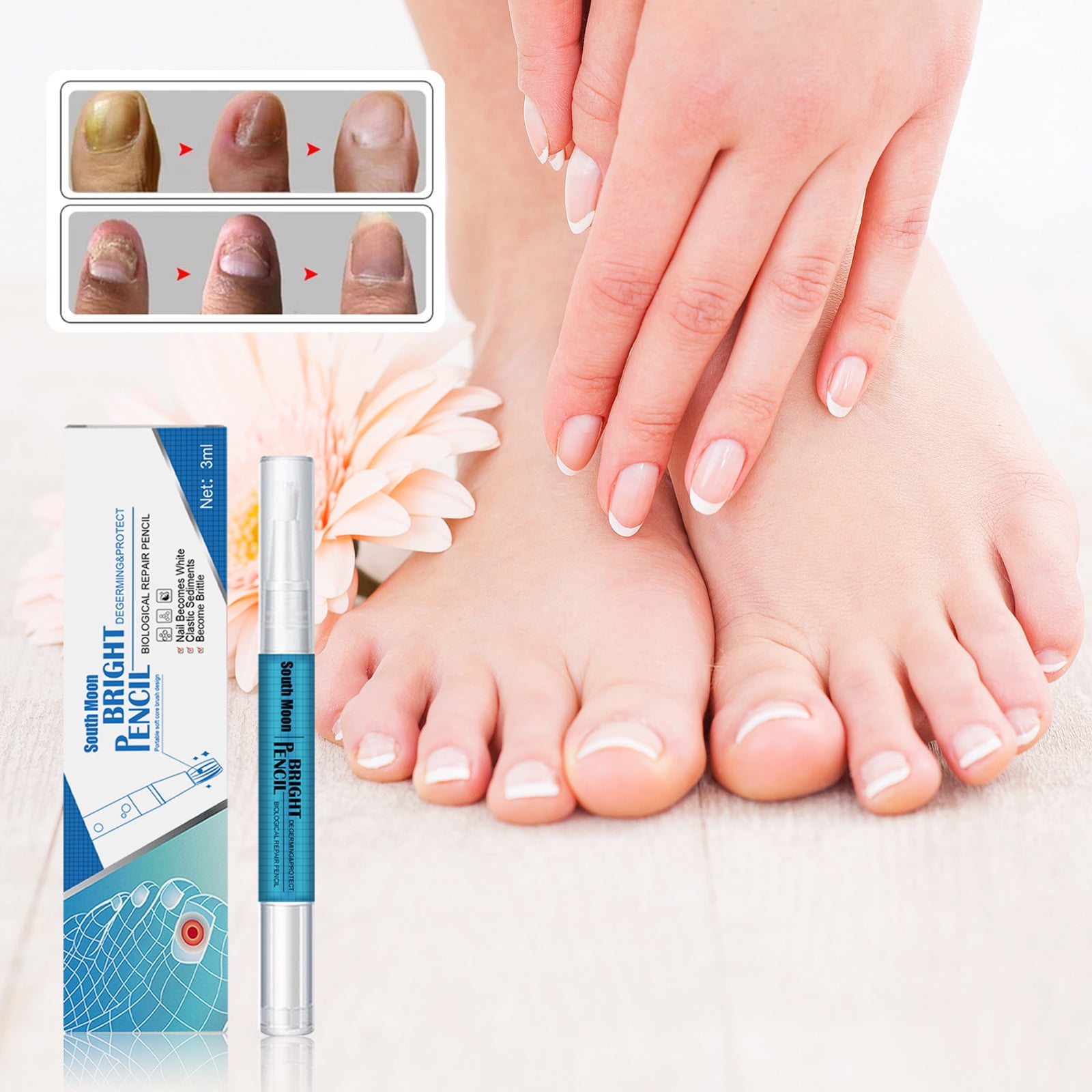 South Moon Nail Fungus Repair Solution, hand and foot thickening
