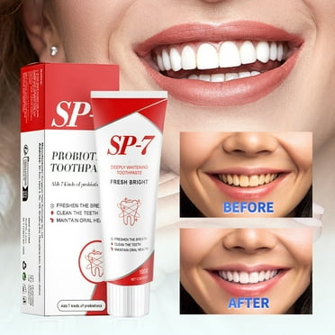 Sp 7 Probiotic Toothpaste Sp7 Toothpaste (1PCS) Gel Toothpaste Toddler Toothpaste 2-4 Baby Toothbrush And Toothpaste 12 Months And up Bleeding Gums Baby Training Toothpaste 12 Months And up in between