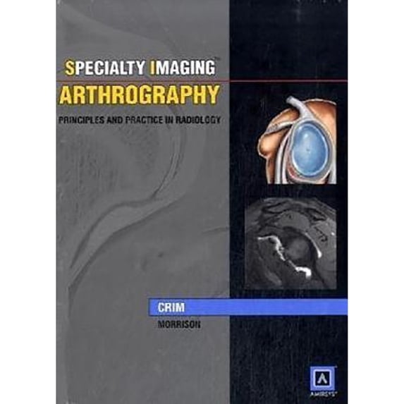 Pre-Owned Arthrography: Principles and Practice in Radiology (Specialty Imaging) (Hardcover) 1931884153 9781931884150