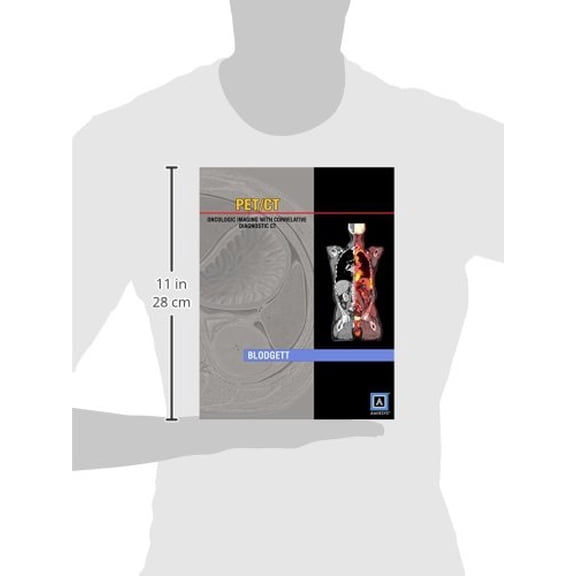 Pre-Owned Specialty Imaging PET/CT: Oncologic Imaging with Correlative Diagnostic CT Blodgett, Todd M., M.D.; Ryan, Alex, M.D.; Almusa, Omar, M.D. and Papachristou, Marios, M.D.