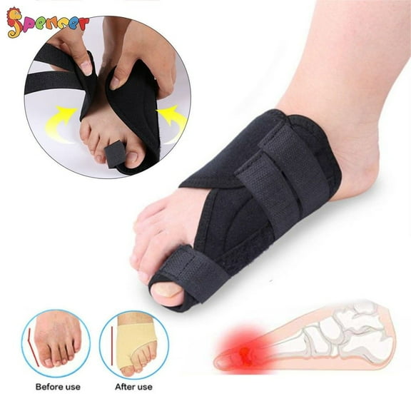 Spencer 1Pair Big Toe Straighteners Separators Bunion Correctors Hallux Valgus Pain Relief Orthopedic Splints Brace Straps "Size S"