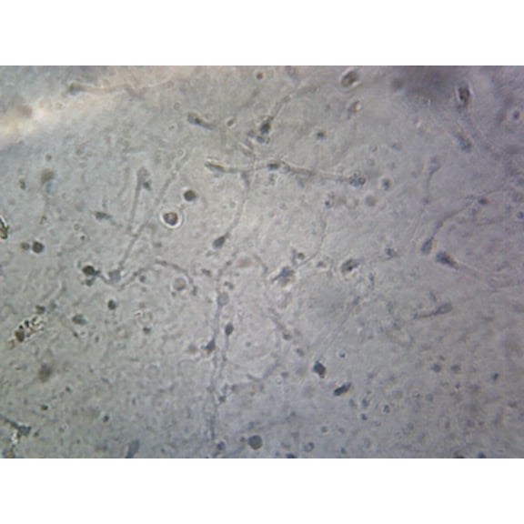 Sperm, Human; Smear by Go Science Crazy