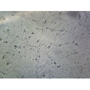Sperm, Human; Smear by Go Science Crazy