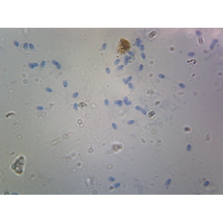 Sperm, Mammalian; Smear by Go Science Crazy