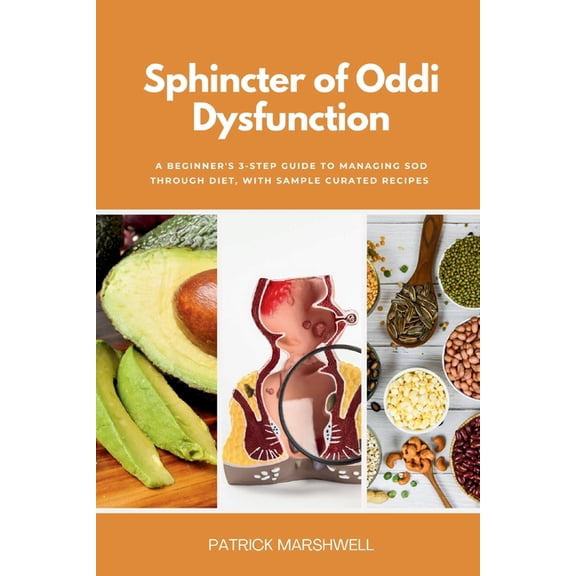 Sphincter of Oddi Dysfunction: A Beginner's 3-Step Guide to Managing SOD Through Diet, With Sample Curated Recipes, (Paperback)
