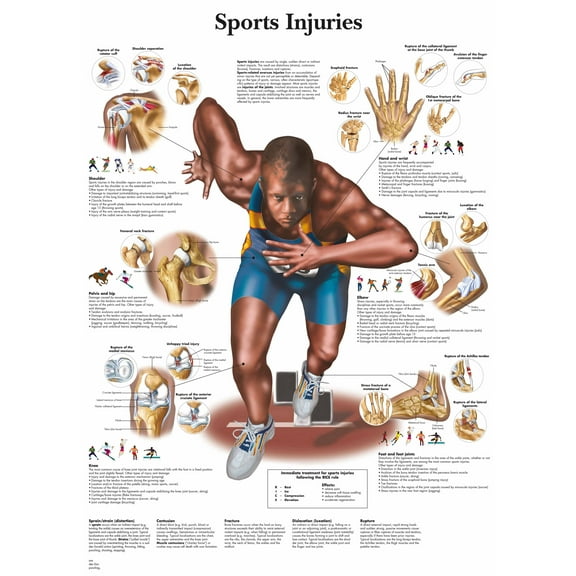 Sports Injuries Wall Art Posters Canvas Print Artwork Wall Chart Human Anatomy Wall Painting Office Hospital Room Home Decoration (without Framed),Multicolor,16x19.7 inch(40x50 cm)