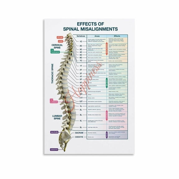 Spinal Misalignment Effects Chart And Spine Nerve Reference Guide Poster Canvas for Living Room Bedroom Decor
