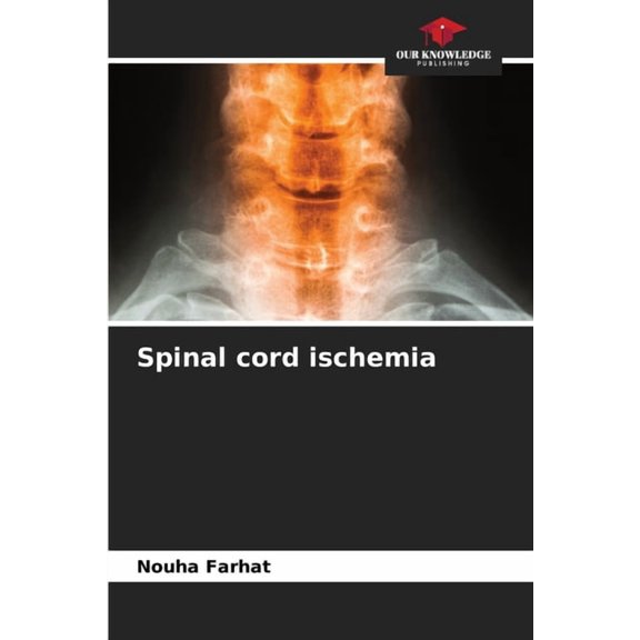 Spinal cord ischemia, (Paperback)