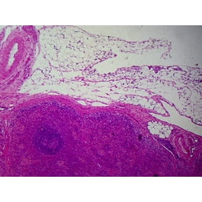 Spleen, Mammalian; Section; H&E Stain