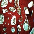 thumbnail image 1 of Spongy Bone Section (Mammal), Prepared Microscope Slide - 75 x 25mm - Anatomy, Biology & Microscopy - Eisco Labs, 1 of 2