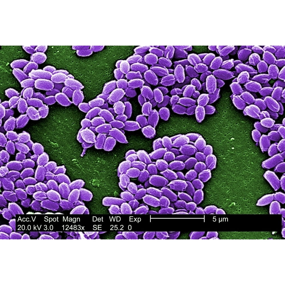 Spores From An Anthrax Bacteria. These Spores Live For Many Years ...