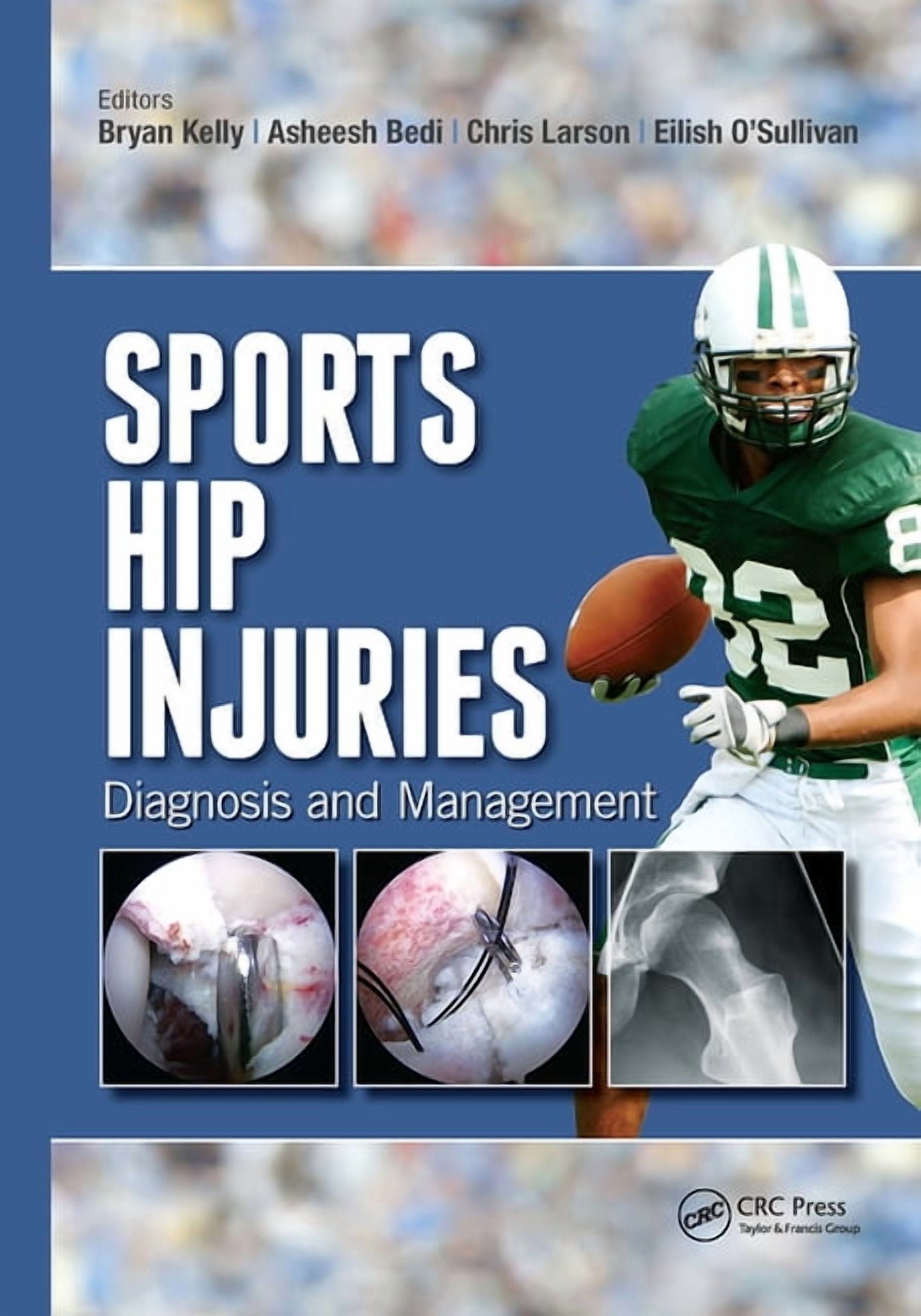 Sports Hip Injuries: Diagnosis and Management, (Hardcover) - Walmart ...