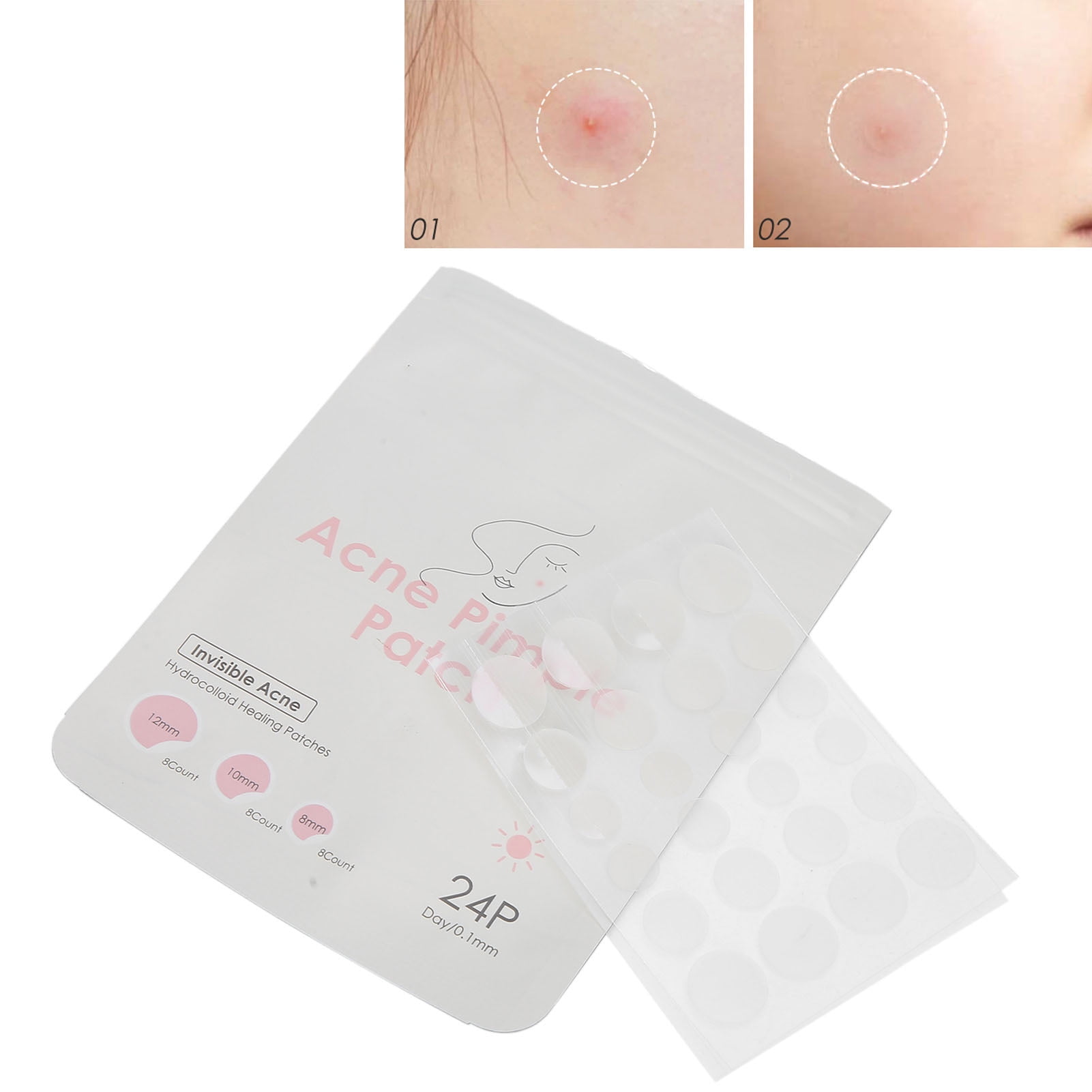 Spot Pad For Early Stage And Deep Pimples Tea Tree Tranparent Skin Care