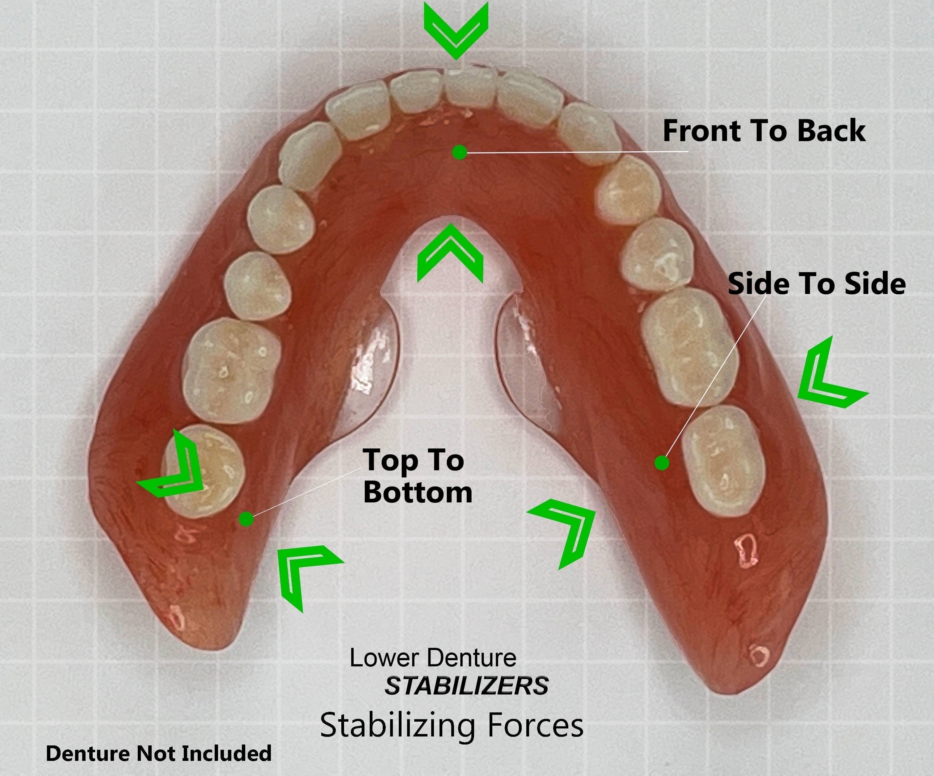 Stabil-Dent Do-It-Yourself Lower Denture Stabilizer Kit, Clear, DIY Kit