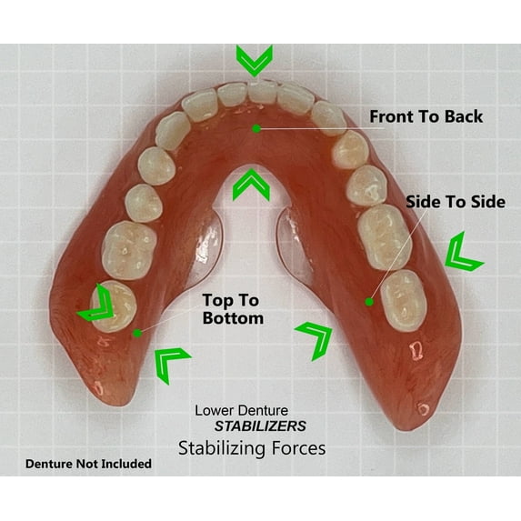 Stabil-Dent Do-It-Yourself Lower Denture Stabilizer Kit, Clear, DIY Kit