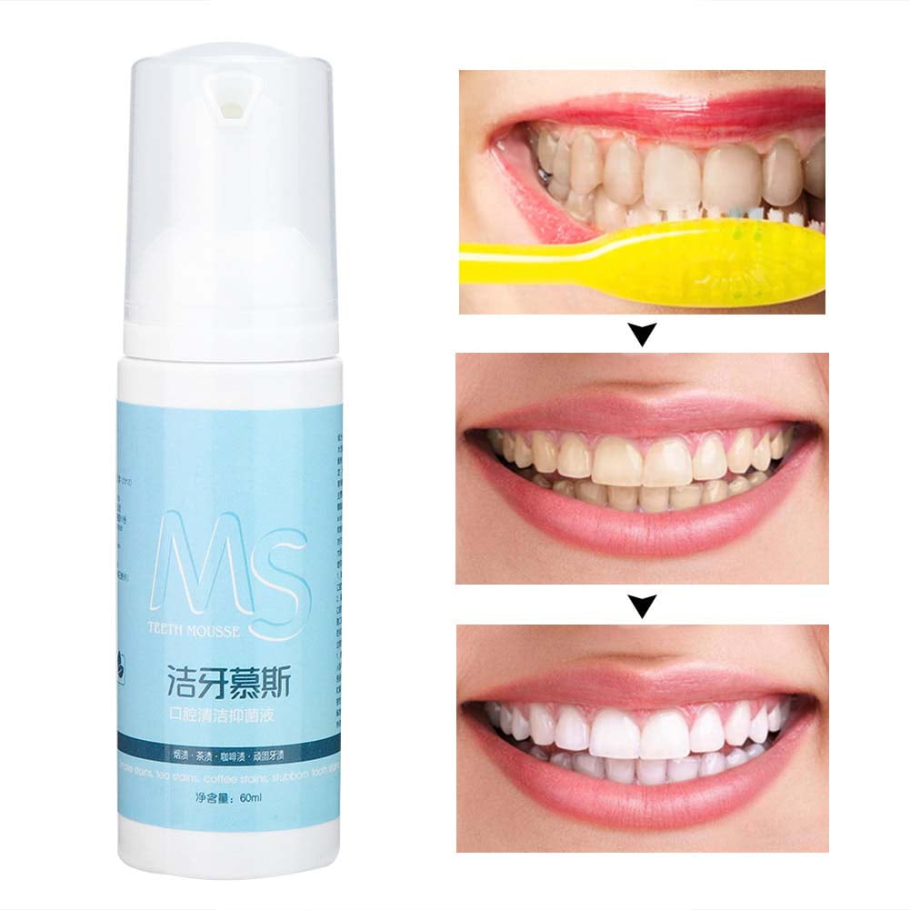 Stain Remover Toothpaste, Cleaning Mousse Toothpaste Teeth Bleaching Oral Hygiene Removes Plaque