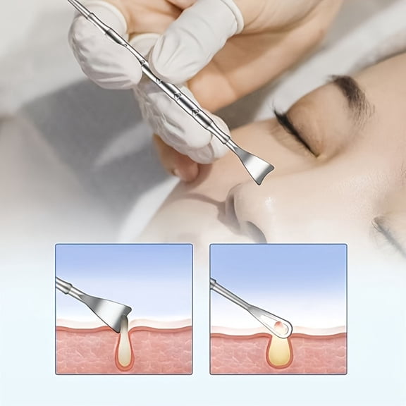 Stainless Steel Blackhead Remover Tool For Face Pore Cleaner Comedone Extractor For Care And Facial Spa