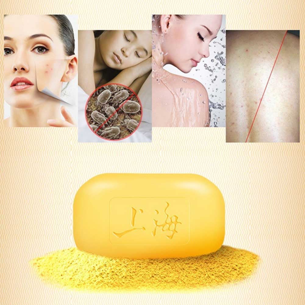 Stamens Bathroom Supply,Sulfur Soap For Eczema Acne Psoriasis Seborrheic Eczema Antifungal