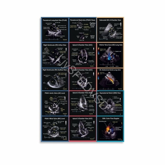 Standard Echocardiogram Views Poster Cardiac Ultrasound Imaging Reference Chart Canvas Painting Wall Art