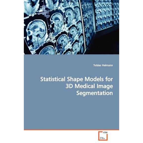 Statistical Shape Models for 3D Medical Image Segmentation (Paperback)
