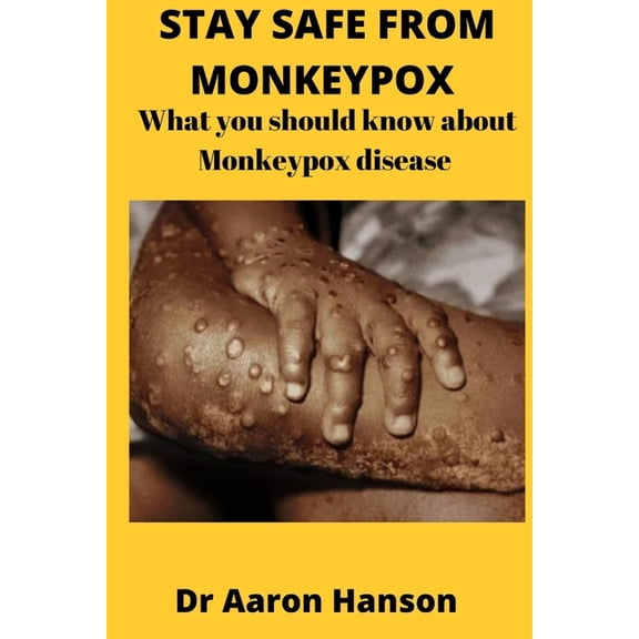 Stay Safe from Monkeypox : What You Should Know About Monkeypox Disease (Paperback)