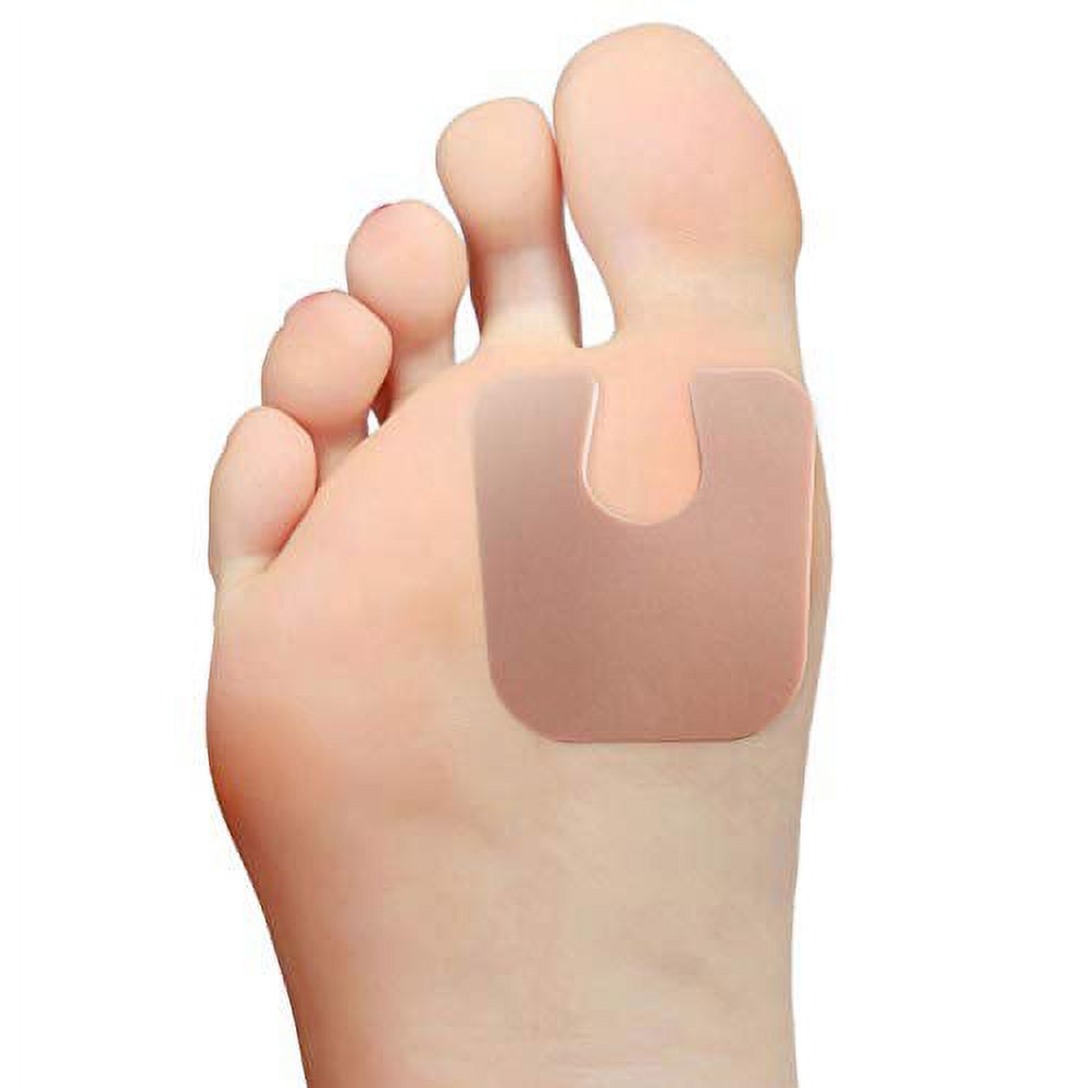 Steins Adhesive Foam Metatarsal Pads, Callus Pads, Bunion Pads, U