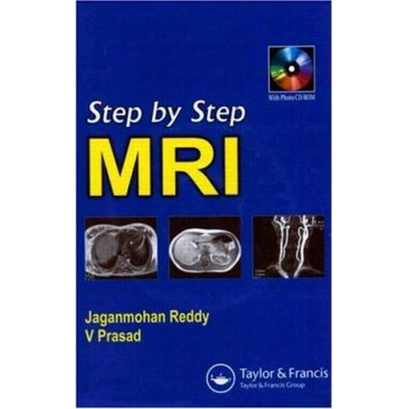 Pre-Owned Step by Step MRI (Paperback) 184184537X 9781841845371