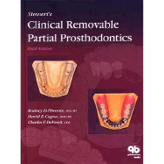 Pre-Owned Stewart's Clinical Removable Partial Prosthodontics (Hardcover) 0867154179 9780867154177