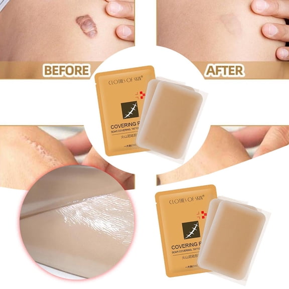 Stickers 2 Concealer Patch for Imperfections - Silicone Texture Transparent Patch for Casual Home Use, 14x10 cm, Brown